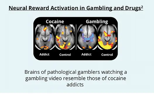 Brain Scan Image Neural Reward Gambling